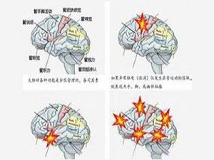 Sudden collapse of mind